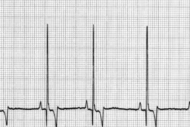 E_25_04_01_ECGs - Easy as 123!_300x200.png