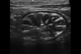 E_26_09_09_Beyond_the_Belly_Gastrointestinal_Ultrasound_in_Dogs_and_Cats_image_300x200.png