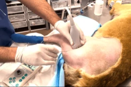 Opioids vs Locoregional Anesthesia 