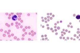 E_26_10_06_Lets talk feline anaemia II Feline infectious anaemias_300x200.png