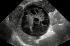 Ultrasound Modular Course Oct/Nov 26 - Module 1 FREE