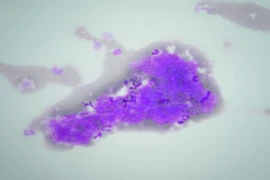 Image 25.06 300x200 (1).png