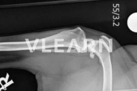 2547_Bild_Vlearn.png