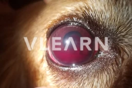 The eye is an innocent bystander. Ocular manifestations of systemic diseases