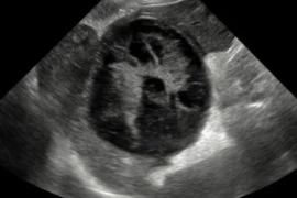 Ultrasound_Titelbild_300x200.jpg