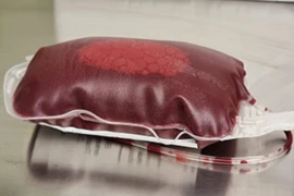 D_25_08_19_Bluttransfusionen_Bild_300x200.png
