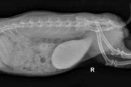 Bladder be safe 300x200 (1).jpg