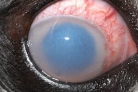 <span class="navbar-label">So much pressure! Understanding and treating glaucoma</span>