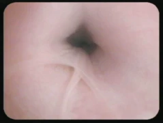 Harninkontinenz_300x200.jpg