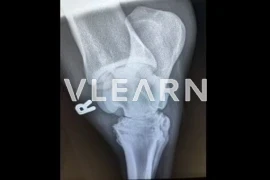 2569_Bild_Vlearn.png