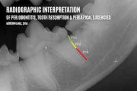 E-25_05_19_Vdent Masterclass_Radiographic interpretation of Periodontitis, Tooth Resorption and Periapical Lucencies_300x200.png