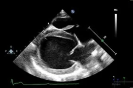 Core - Cardiology Basics Course Aug - Sept 2026