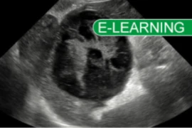 Ultrasound Modular Course April 2025