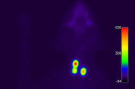 feline-hyperthyreose-1.jpeg