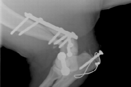 fracture-fixation-how-to-avoid-the-dreaded-revision-surgery.png