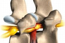 spinal-shock-and-trauma-for-emergency-veterinarians-CL1461829609.png