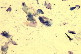 hautinfektionen-diagnostizieren-und-therapieren-a-teil-1-pilzinfektion-der-haut.jpeg