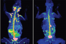 Staging the Oncology Patient