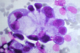 pitfalls-of-cytology.png