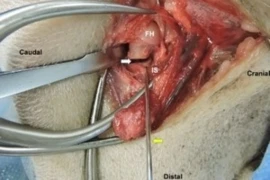 Femoral Head and Neck Ostectomy