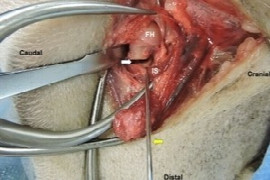 Femoral Head and Neck Ostectomy