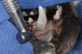 Dental Extractions