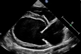 Causes of secondary dilated cardiomyopathy in dogs