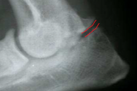 Advances in the Management of Elbow Dysplasia 