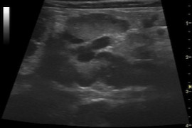 top-tips-to-perform-a-full-abdominal-ultrasound-in-your-practice.jpeg