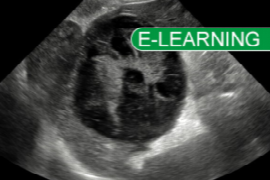Ultrasound Website 300x200 with banner.png