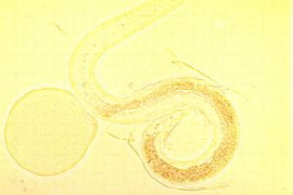 toxocara-canis-und-t-cati-zwei-spulwurmarten-mit-hoher-humanmedizinischer-relevanz.jpeg