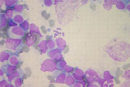 leishmaniose-diagnose-therapie-impfung.jpeg