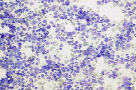 cytology-sample-collection-preparation-and-handling-for-nurses-1.jpeg