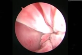 Endoscopy of the airways in dogs and cats