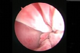 Endoscopy of the airways in dogs and cats