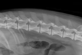 Bandscheibenvorfälle & Co - Der Paraparesepatient in der Bildgebung