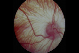 understanding-the-canine-fundus-part-2-pathological-changes-CL1474499510.jpeg