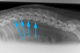 Intervertebral Disc Disease