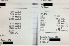emergency-blood-tests-electrolytes-and-acid-base-monitoring-and-management-of-disturbances-1.jpeg