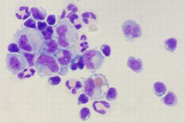 CSF evaluation - Cytology and Infectious Disease Diagnostics