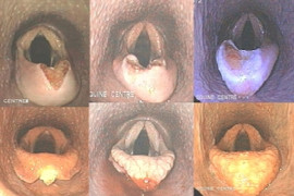 Equine upper respiratory tract surgery – a revision of where we are and what is new