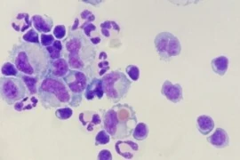 CSF evaluation - Cytology and Infectious Disease Diagnostics (for Nurses)