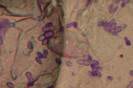 malassezia-dermatitis-a-common-but-overlooked-problem.jpeg