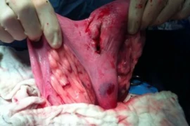 Optimising Outcomes in the Canine Caesarean Section