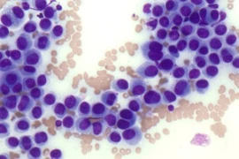 Evaluation of Cytology Samples for Nurses