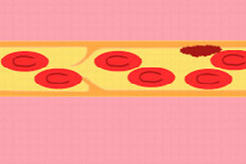 won-t-clot-why-not-1.jpeg