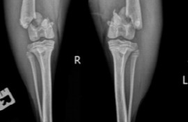 fracture-classification-acute-management-and-decision-making-1.jpeg