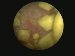 practical-tips-for-common-urinary-tract-disorders-1.jpeg