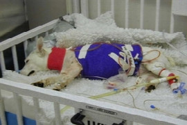 peritoneal-dialysis-1.jpeg