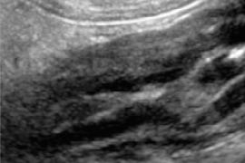 ultrasonographic-features-of-non-neoplastic-vs-neoplastic-intestinal-diseases-in-dogs-and-cats.png